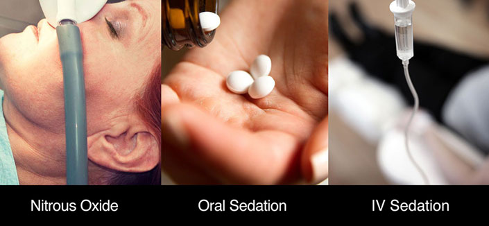 Sedation Services